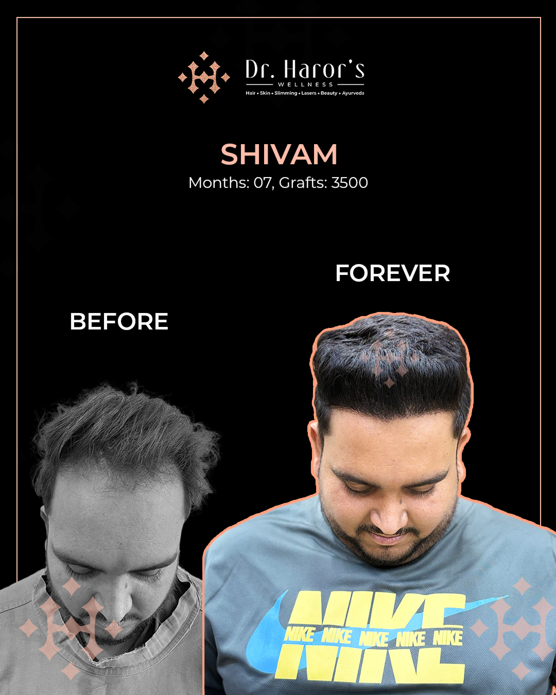 1 - Before and After